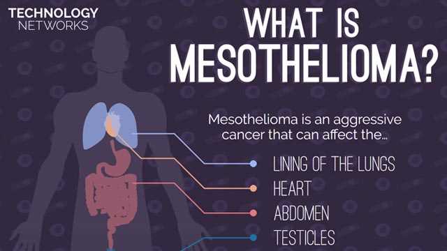  What is Mesothelioma?