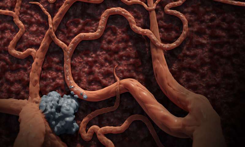 Cancer immunotherapy 'uniquely suppressed' by liver tumors