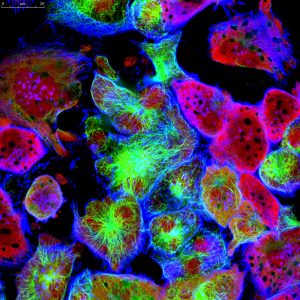 $20 million gift to establish a cancer immunotherapy laboratory – News – The University of Sydney
