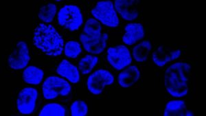 Engineering an immunotherapy to outwit cancer — and launch a biotech – STAT