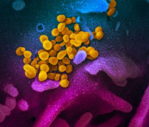 COVID-19 Vaccine Targets Espied with Cancer Immunotherapy Eyes – Genetic Engineering & Biotechnology News