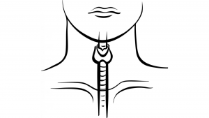 Thyroid Toxicity May Predict Response to Immunotherapy in Metastatic NSCLC – Targeted Oncology