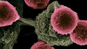 CD19 in Brain Cells May Be Cause of Immunotherapy-Related Neurotoxicity – Technology Networks