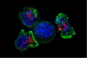 Fighting breast cancer with nanotech, immunotherapy – Medical Xpress
