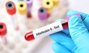 Taking the itch out of cancer immunotherapy – Medical Xpress