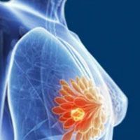 FIP200 Deletion May Enhance Response to Immunotherapy in Breast Cancer – OncLive
