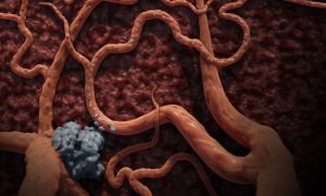 Cancer immunotherapy ‘uniquely suppressed’ by liver tumors – Medical Xpress