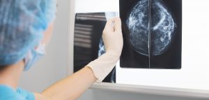 Immunotherapy-Chemotherapy Combo Beneficial In Triple-Negative Breast Cancer – Cancer Health Treatment News